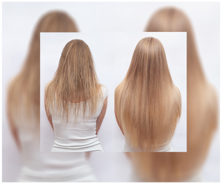 Gélules contre la chute des cheveux à effet épaississant et fortifiant Follixin 60 gélules