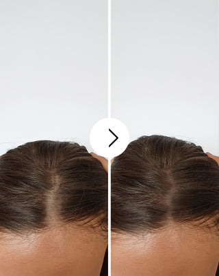 Gélules contre la chute des cheveux à effet épaississant et fortifiant Follixin 60 gélules