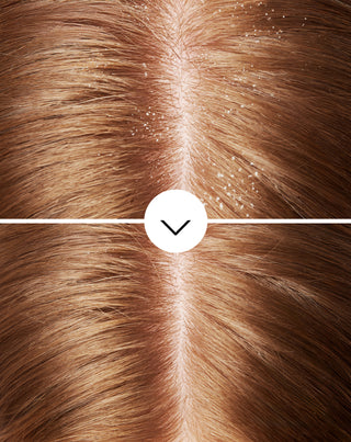 Shampoing antipelliculaire hydratant Nutridome à la piroctone olamine - 2