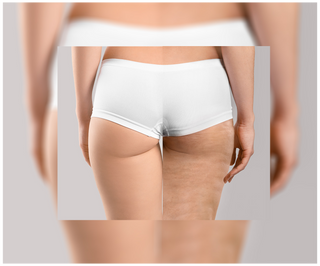Comprimés de traitement anti-cellulite et pour améliorer les qualités de la peau aux extraits naturels Cellinea 60 gélules - 6