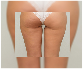 Comprimés de traitement anti-cellulite et pour améliorer les qualités de la peau aux extraits naturels Cellinea 60 gélules - 5