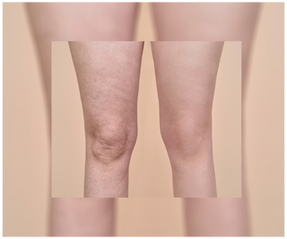 Comprimés de traitement anti-cellulite et pour améliorer les qualités de la peau aux extraits naturels Cellinea 60 gélules - 4