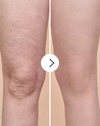 Comprimés de traitement anti-cellulite et pour améliorer les qualités de la peau aux extraits naturels Cellinea 60 gélules