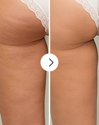 Comprimés de traitement anti-cellulite et pour améliorer les qualités de la peau aux extraits naturels Cellinea 60 gélules