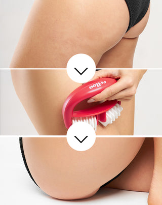 Masseur anti-cellulite avec picots pour combattre la cellulite et réduire les tensions musculaires Crush my Celloo