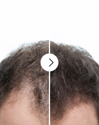Gélules contre la chute des cheveux à effet épaississant et fortifiant Follixin 60 gélules