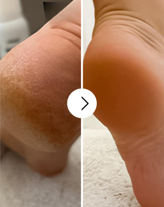 Crème adoucissante pour les pieds Nutridome à l'urée et au beurre de karité