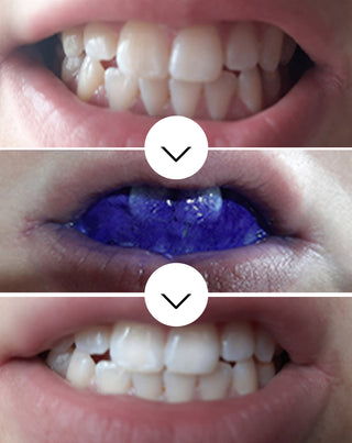Sérum White Bite correcteur de la couleur des dents 30 ml - Smilebite