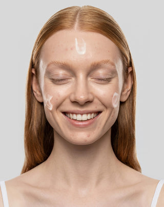 Crème de jour anti-acné à l'acide salicylique et à l'acide azélaïque pour peaux à imperfections Anti-Acne Orphica Clinic 50 ml - 2
